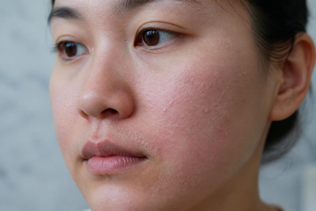 découvrez les causes des petits boutons blancs qui apparaissent après l'épilation du visage, avec des explications claires et des conseils pratiques pour les prévenir et les traiter efficacement.