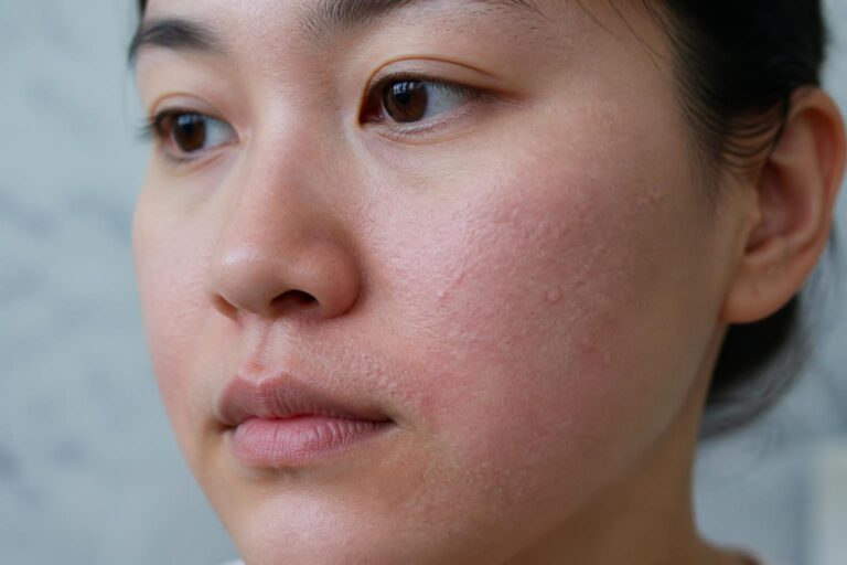 découvrez les causes des petits boutons blancs qui apparaissent après l'épilation du visage, avec des explications claires et des conseils pratiques pour les prévenir et les traiter efficacement.