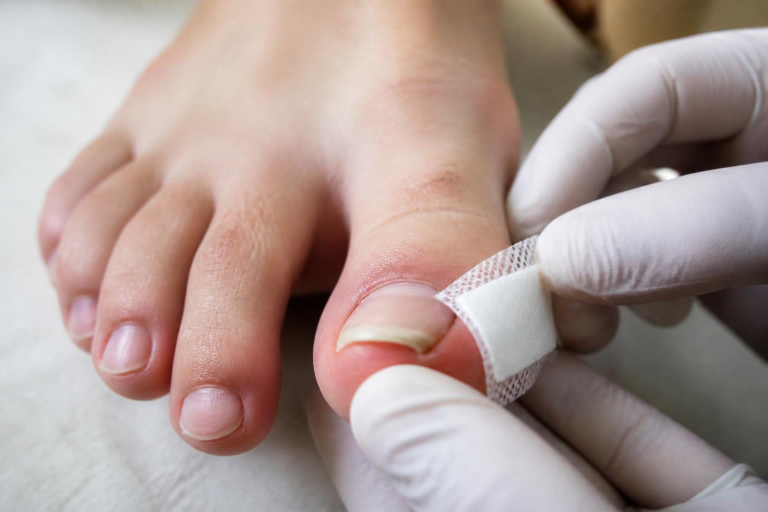 découvrez les principales causes d'un ongle qui se décolle et les solutions efficaces pour le réparer rapidement et prévenir ce problème.